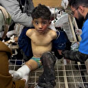 İsrail saldırısında bacağı kesilen Gazzeli çocuğun sessiz çığlığı yürek dağladı