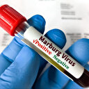 OMS : Une épidémie présumée du virus de Marburg fait huit morts en Tanzanie