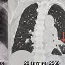 Doktorları şaşırtan röntgen: Aylarca kapalı olan odada kaldı sonuçlarına kendisi bile inanamadı
