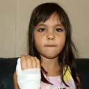 Anaokulunda korkunç olay: Dört yaşındaki çocuğun parmağı koptu