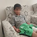 Bursa'da sahipsiz köpeğin saldırdığı çocuk bacağından yaralandı