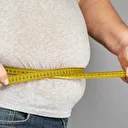 Obezite tedavisinde erken cerrahi müdahale başarıyı artırıyor