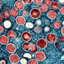 La Namibie confirme son premier cas de mpox et déclare une épidémie