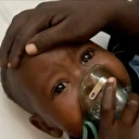 Nijerya'da Lassa ateşi nedeniyle ölenlerin sayısı 172'ye yükseldi