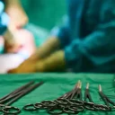 Mide küçültme ameliyatında ölüme fezleke: Doktorluktan men edilmesine rağmen ameliyat yaptı