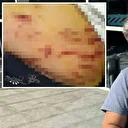 Mersin’de cins köpek dehşet saçtı: Köpeğin ısırdığı anne yaşananları anlattı