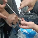 Parmakta sıkışan yüzük hastanede doktor ve itfaiye ekibi tarafından çıkartıldı