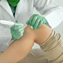 Proloterapi ile şifa buluyorlar: Başarı oranı yüzde 90'ın üzerinde