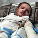 Gazze’de İsrail ordusundan kalan patlayıcıların infilakı Filistinli Mecid'i ağır yaraladı