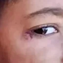 Öğrencinin yüzünde sigara söndüren temizlik görevlisi tutuklandı