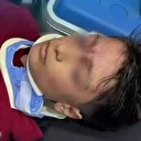 Okul çıkışı izdiham: 23 öğrenci hastaneye kaldırıldı