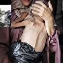 Gazze'de açlıktan ölümler giderek artıyor