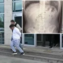 Uşak’ta midelerinden uyuşturucu çıktı: 3 kişi tutuklandı