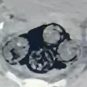 Radyolojik muayeneyle tespit edildi: Vücudundan 140 gram uyuşturucu çıkan şahıs tutuklandı 