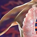 Sessiz salgın: 2024’te 1,2 milyondan fazla kişi tüberkülozdan öldü