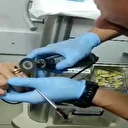 Batman’da parmağına sıkışan yüzüğü itfaiye çıkardı