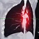 Vücuda sinsice yayılıyor: Son 5 yılda yüzde 15 arttı, basit öksürükle başlayıp ölüme kadar götürüyor