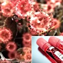 İnsanlarda ilk H5N5 kuş gribi vakası ölümle sonuçlandı