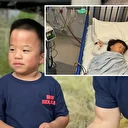 Gen terapisi gören ilk Hunter sendromu hastası gösterdiği gelişmeyle dikkati çekti