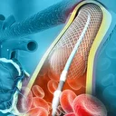 Profesörden 'kalp stentlerinin tıkanabileceği' uyarısı