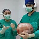 Karnı 2 ayda 9 aylık hamile gibi büyüyen kadının içinden karpuz kadar kitle çıkarıldı