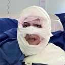 Kadıköy'de bir kadın ateşe verildi: Kendimi güvende hissetmiyorum