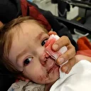 Ankara'da 2 kardeşe saldıran pitbull ve sahibi yakalandı