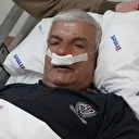 Yıllarca burnu tıkalı yaşadı: 65 yaşındaki adamın burnundan 100 gram taş çıktı