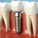 Milyonları ilgilendiren teklif Meclis'e sunuldu: İmplant tedavisini SSK karşılayacak