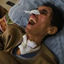 İsrail saldırısında ağır yaralanmıştı: Filistinli Hamed hayatta kalma mücadelesi veriyor