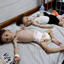 ONU: plus de 2.300 enfants de Gaza traités pour malnutrition aiguë en janvier