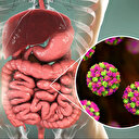 Dünyanın yeni salgını noravirüs: Nedir belirtileri neler nasıl korunulur?