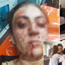 Sinem'i 7 yerinden bıçaklayan eski kocaya iyi hal indirimi: Hakaret etti