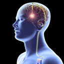 Sessiz tehlike: Beyin implantları bakterilere kapı aralıyor