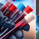 Kan grubunuz kanser riskinizi belirliyor: Bu kan grubuna sahip kişiler kansere daha yatkın