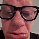 Ünlü komedyen dondurma yedi hastanelik oldu: Yüzünü görenler şaştı kaldı