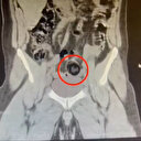 İranlı uyuşturucu kuryesi yakayı ele verdi: Yasaklı maddeleri sakladığı yer 'yok artık’ dedirtti