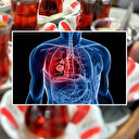 Sakın böyle demlemeyin: 'Çay değil zehir içiyormuşuz' Uzmanlardan hayati uyarı