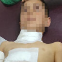 Sahipsiz köpek saldırısı: 10 yaşındaki Ahmet yaralandı