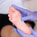 El ayak ağız hastalığı nedir, nasıl bulaşır? Aileler nelere dikkat etmeli?