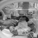 Gazze'deki Sağlık Bakanlığı: "Yetersiz beslenme ve abluka koşulları sebebiyle yenidoğanların çoğu sağlık problemleri yaşıyor"