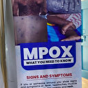 Sierra Leone: plus de 1.100 cas de mpox recensés et 9 décès (autorités)