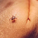 Yaz aylarının sessiz katili: Vücutta sinsice ilerliyor, işte en önemli belirtisi ve ilk müdahalede yapılması gerekenler