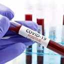 ABD'de her hafta 300'den fazla kişi Kovid-19 nedeniyle hayatını kaybediyor