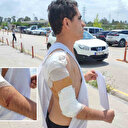 Hastane yolunda sahipsiz köpek saldırdı