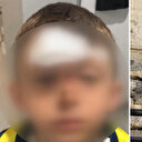 Eyüpsultan'da kreşteki çocuk 2 metre yükseklikten inşaat alanına düştü