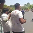 Hindistan’daki uçak kazasında mucizevi kurtuluş: 241 kişinin hayatını kaybettiği enkazdan yürüyerek çıktı