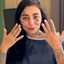 Estetik sonu oldu: Mozambikli sosyal medya fenomeni Türkiye'de öldü, eşi hastaneyi suçladı