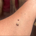 Uzman isimden dikkat çeken 'kene' uyarısı: Kapalı giyinilmeli