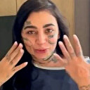 Ünlü fenomenin acı sonu: İstanbul'da reklam anlaşmalı estetik ameliyatı ölümle sonuçlandı